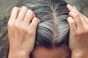 هنوز جوونی و موهات سفید شدن؟ دلیلش رو اینجا بخون 