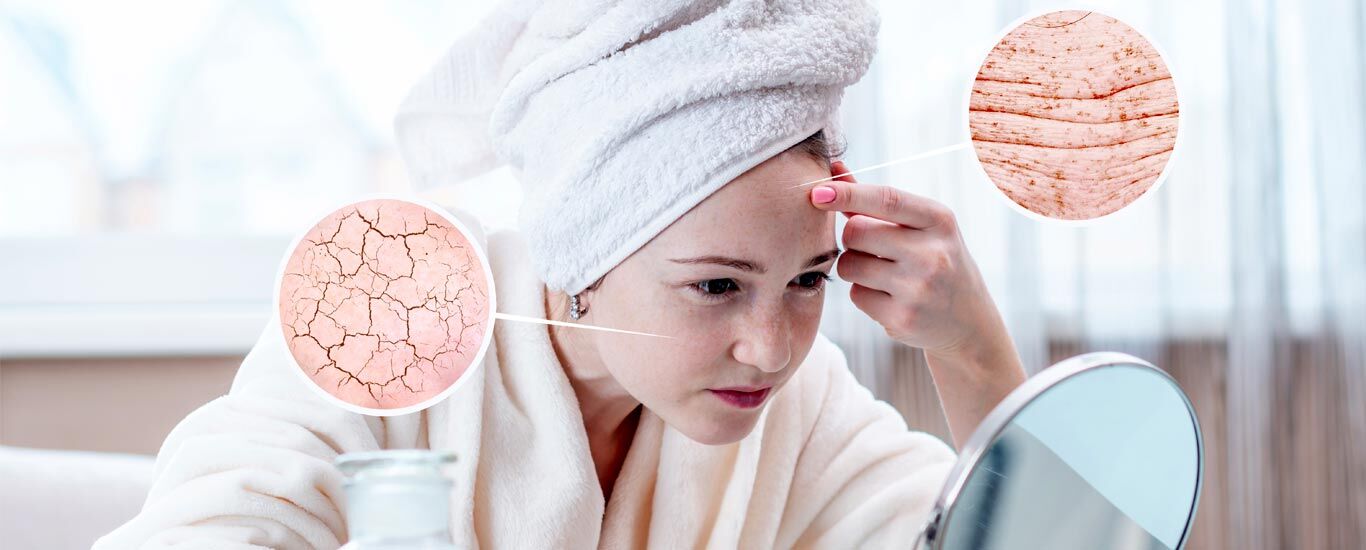 روش های طبیعی رفع خشکی پوست