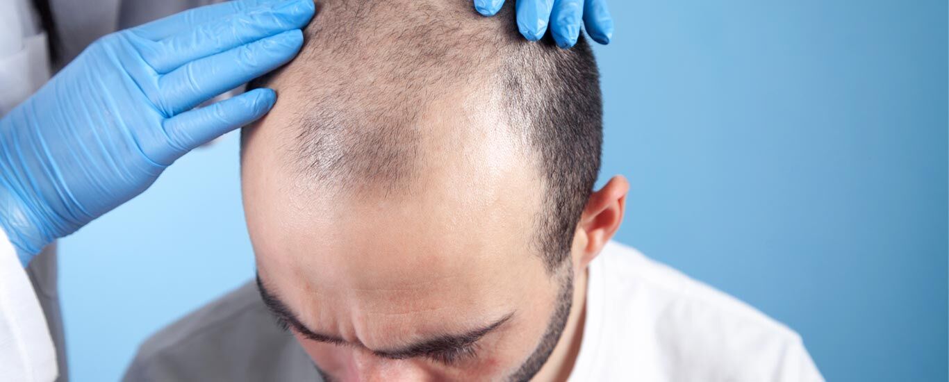 مزاج بلغمی یا سرد و تر چیست و چه خصوصیاتی دارد؟ 