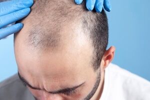 مزاج بلغمی یا سرد و تر چیست و چه خصوصیاتی دارد؟ 