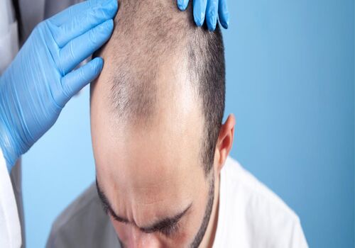 مزاج بلغمی یا سرد و تر چیست و چه خصوصیاتی دارد؟ 