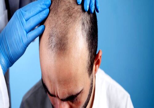 مزاج بلغمی یا سرد و تر چیست و چه خصوصیاتی دارد؟ 