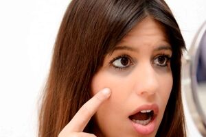 درمان های طبیعی برای رفع سیاهی دور چشم