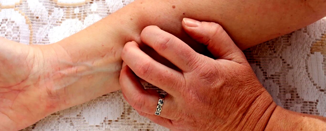 رفع خارش پوست به روش های گیاهی و خانگی