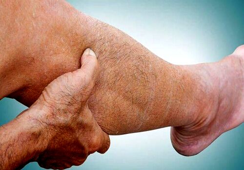 دائما احساس گرفتگی عضله داری؟ این ویتامین ها بهت نرسیده 